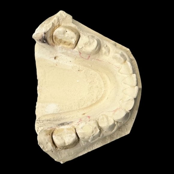 Vintage Plaster Dental Mold - Teeth Tooth Mold - Creepy Oddity - Dental Oddities - Picture 14 of 16